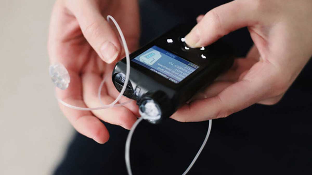 Woman holding her insulin pump in hands