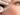 Cosmetic Surgery