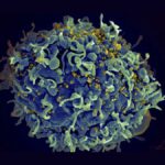 HIV cure breakthrough