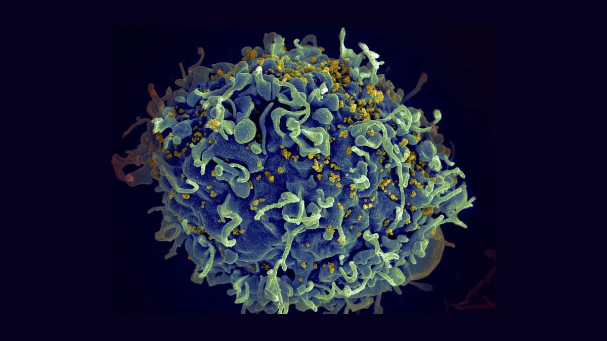 HIV cure breakthrough